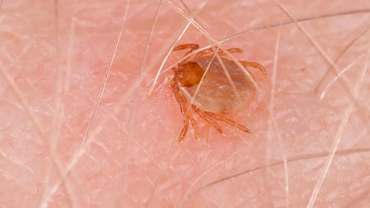 Spotted fever kills 17 people in São Paulo in 2026
