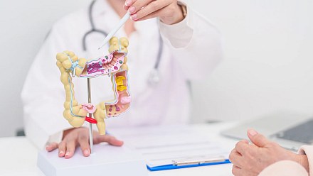 Câncer colorretal: veja quais exames preventivos fazer e em qual idade