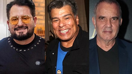 Unrecognizable? Famous men who have had plastic surgery and other aesthetic procedures