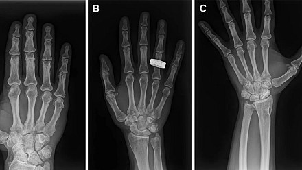 Astronauts take the first X-ray exams in history in space