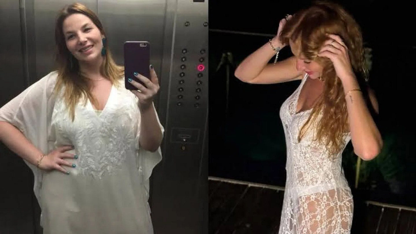 Luiza Zveiter recalls sequelae after bariatric surgery