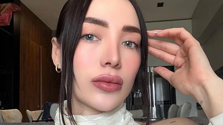 Mexican influencer dies at 30 after plastic surgery
