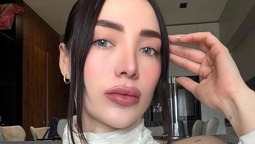 Mexican influencer dies at 30 after plastic surgery