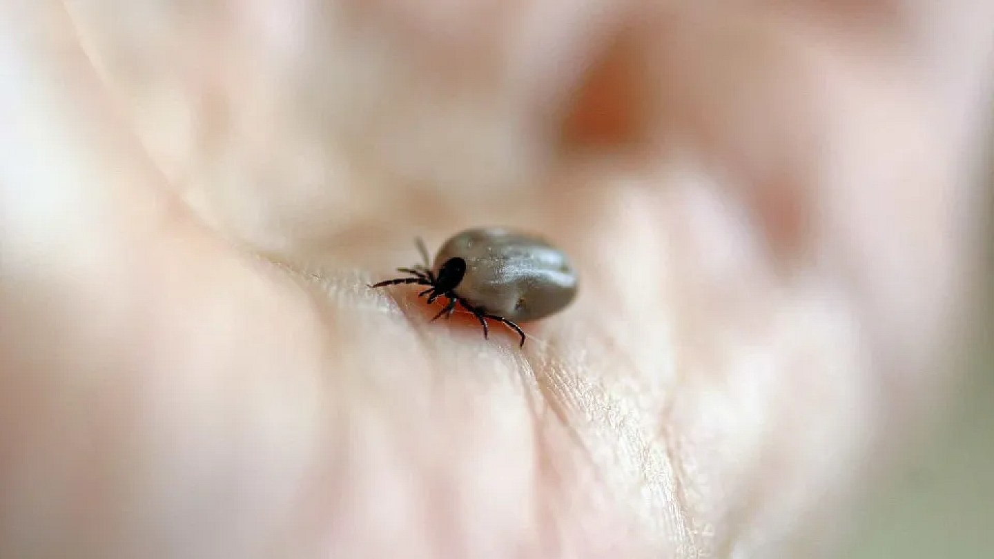 Woman dies of spotted fever at ABC; Ticks were found on the victim's dogs