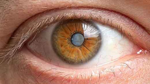Doctor accused of blinding 21 patients in cataract effort is sentenced to 40 years in prison