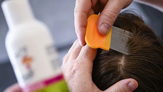 Verdades e mentiras sobre piolhos: o que diz a Ciência