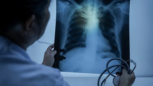 Understand when a respiratory infection can evolve into pneumonia
