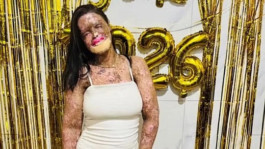 Influencer Káh Felipe dies at age 31 in Fortaleza