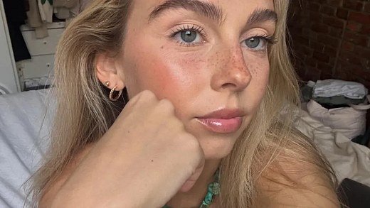 26-year-old influencer dies after battle with rare cancer